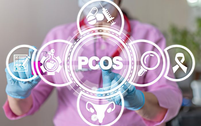 سندرم تخمدان پلی کیستیک (ovarian) (PCOS)